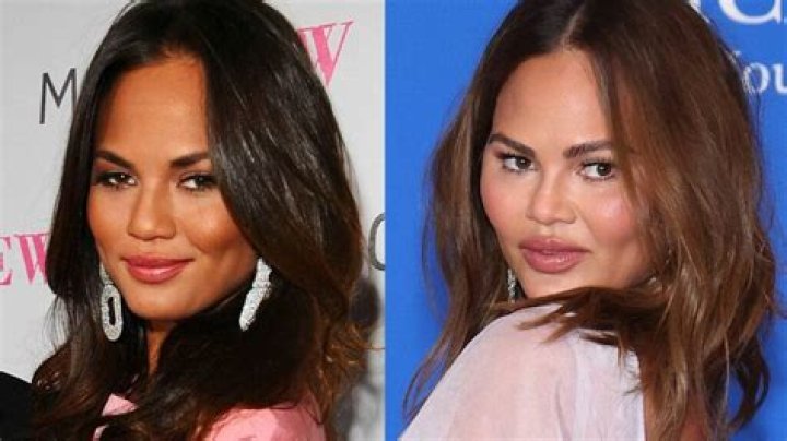 Chrissy Teigen Plastic Surgery: Chrissy's Openness with Representing True Self!