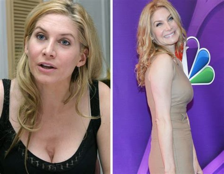 Elizabeth Mitchell Plastic Surgery Before and After