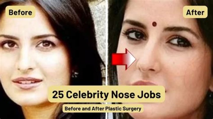 Emily Deschanel Nose Job Plastic Surgery Before and After