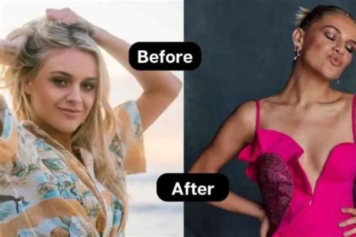 Kelsea Ballerini Weight Loss: Know Everything from Her Struggle to Diet and Everything We Know!