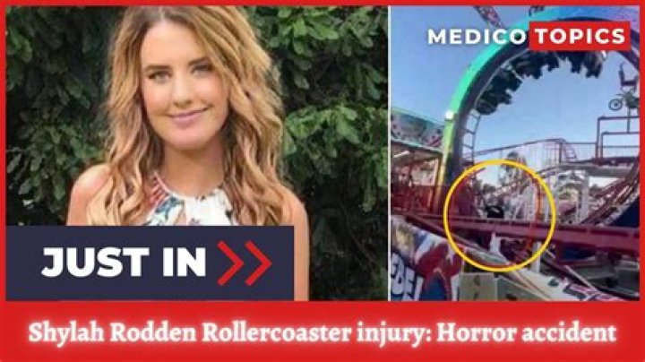 Shylah Rodden Rollercoster Accident: Who is Shylah Rodden?