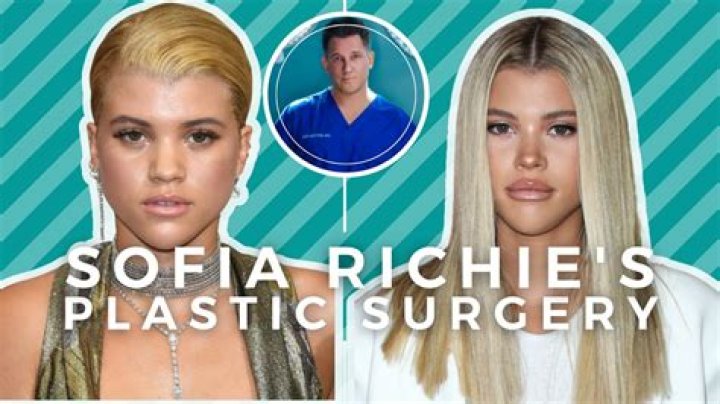 Sofia Richie Plastic Surgery: A Close Examination of Her Nose Job and Lip Filler Choices