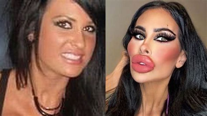 Pictures of Tara Jayne Before Surgery