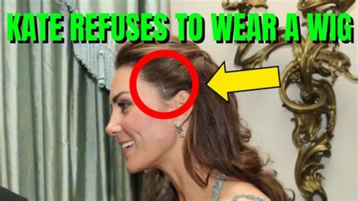 Why Did Kate And Owen Break Up? – Celebrity